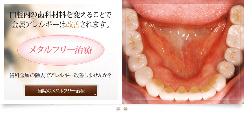 徳島メタルフリーデンタルクリニック【審美治療】　医療法人　浜口歯科