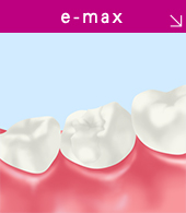 e-max